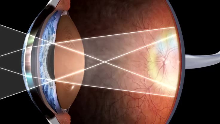 Diabetic retina care pathway poster used in a diabetic eye screening guide